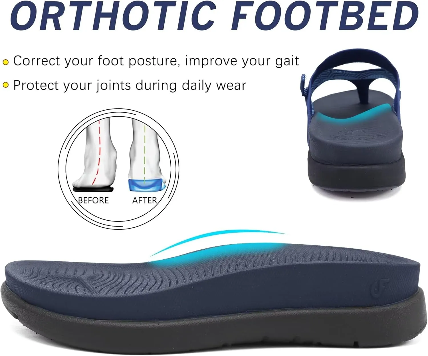 COFACE Womens Fashion Orthotic Flip Flops Recovery Walking Lightweight Athletic Thick Yoga Mat Cushion Thong Sandals With Comfortable Plantar Fasciitis Arch Support